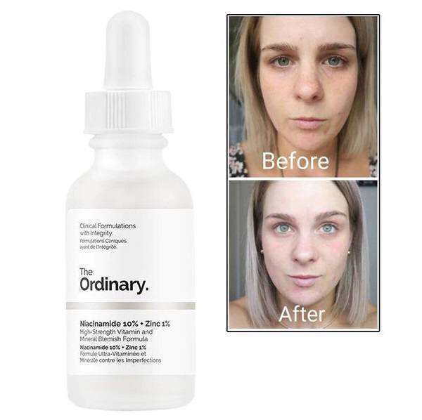 سرم ضد جوش نیاسینامید ۱۰٪ + زینک ۱٪ اوردینری niacinamide + zinc