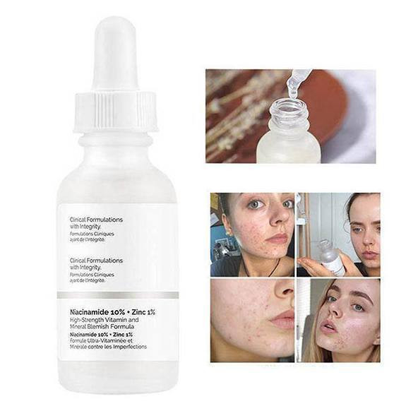 سرم ضد جوش نیاسینامید ۱۰٪ + زینک ۱٪ اوردینری niacinamide + zinc